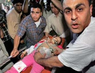 palestinian girl injured in israeli attack